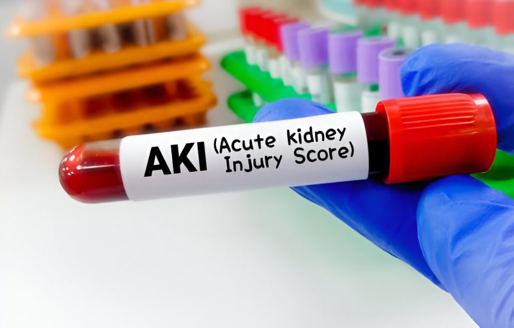 Acute kidney injury (AKI)