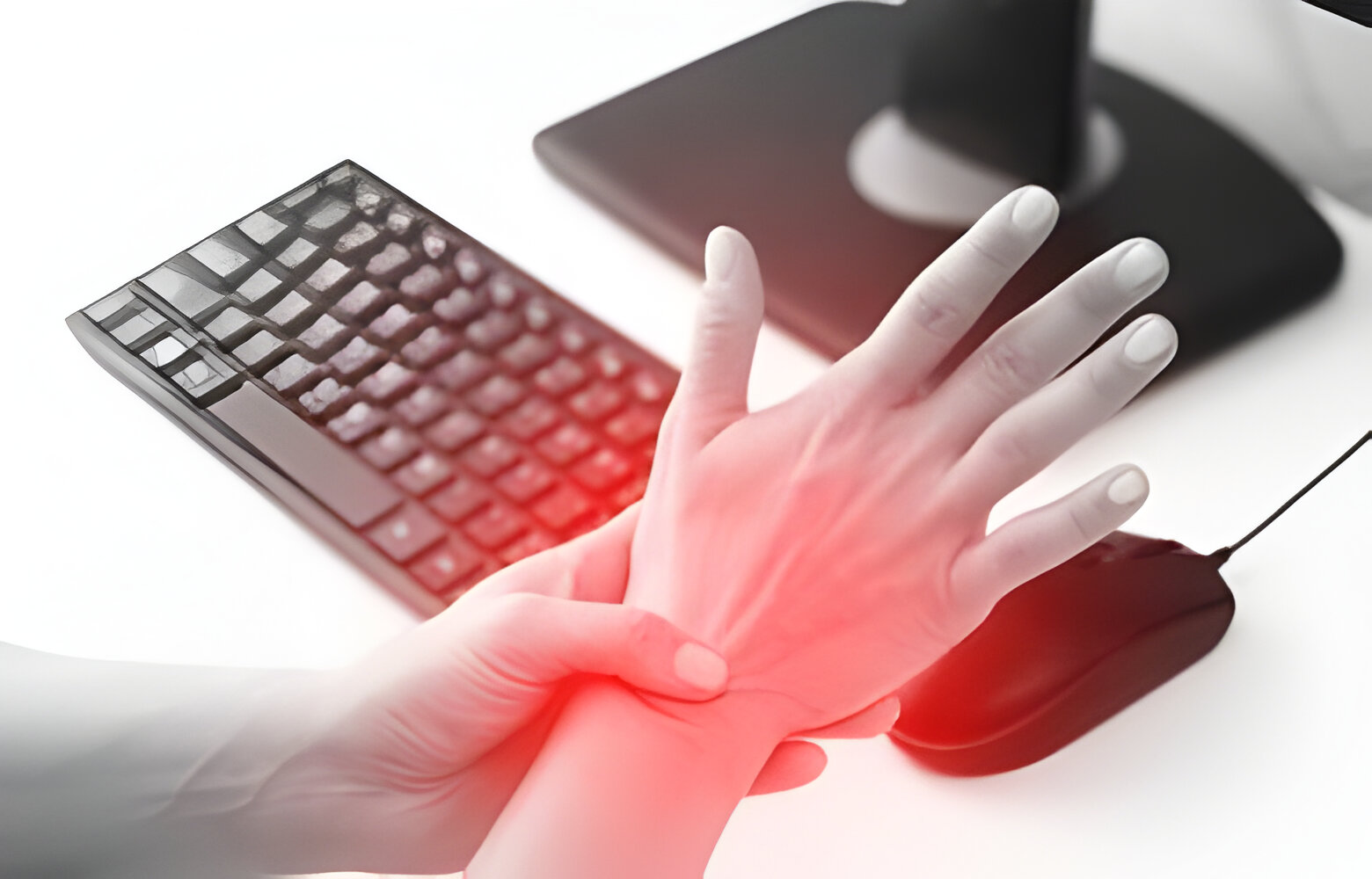 Carpal tunnel syndrome