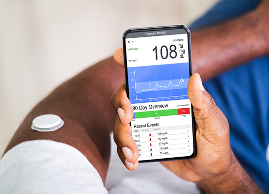 Continuous glucose monitoring (CGM)