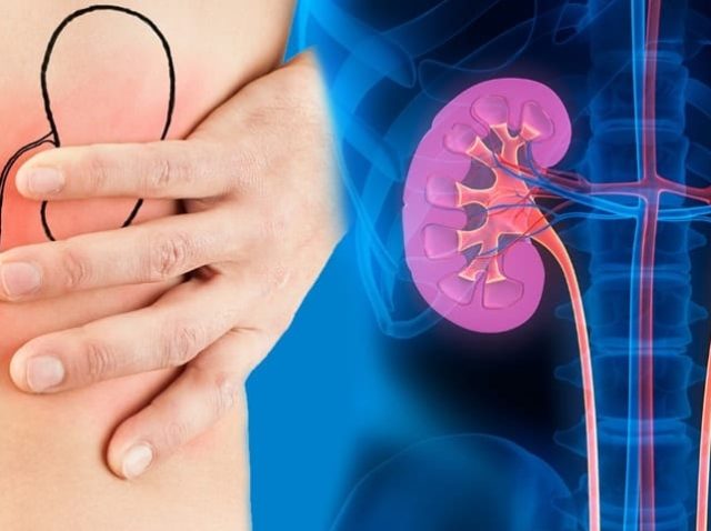kidney specialist in madurai