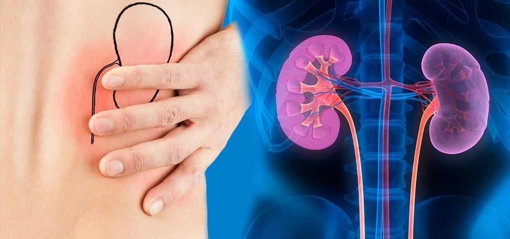 kidney specialist in madurai