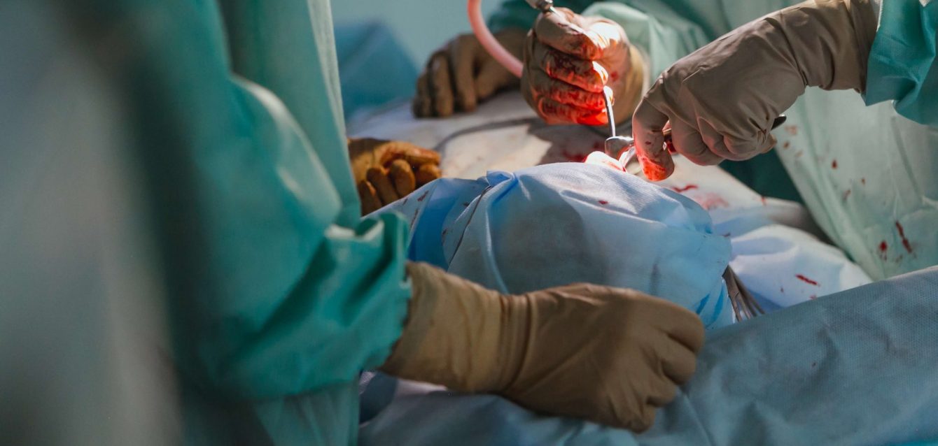 Limb Reconstructive Surgery 101