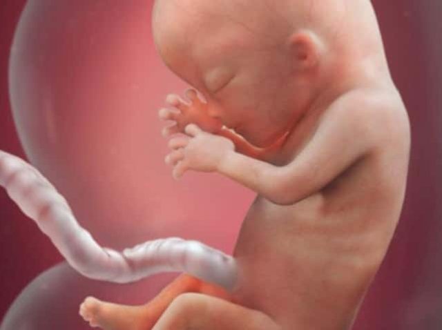 prenatal screening