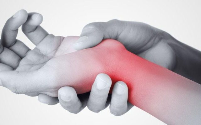 Carpal Tunnel Syndrome
