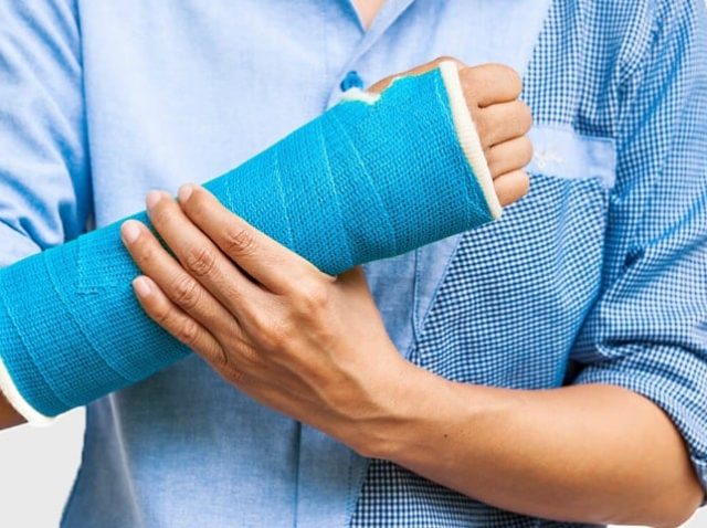Management of fractures